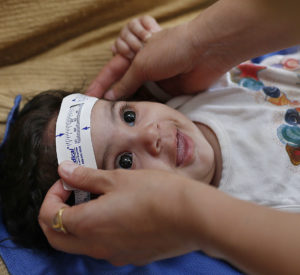 FILE - Infants exposed to the Zika during pregnancy have been born with microcephaly. More than 1,300 babies have born with the birth defect. (AP Photo/Andre Penner)